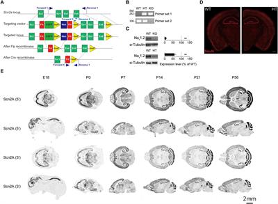 Scn2a Haploinsufficiency in Mice Suppresses Hippocampal Neuronal Excitability, Excitatory Synaptic Drive, and Long-Term Potentiation, and Spatial Learning and Memory